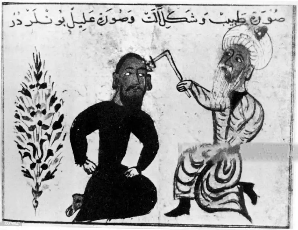 طبيب عربي يعالج مريضاً، على الأرجح يجري عليه عملية كي جرح على مستوى الرأس، خلال العصورر الوسطى.