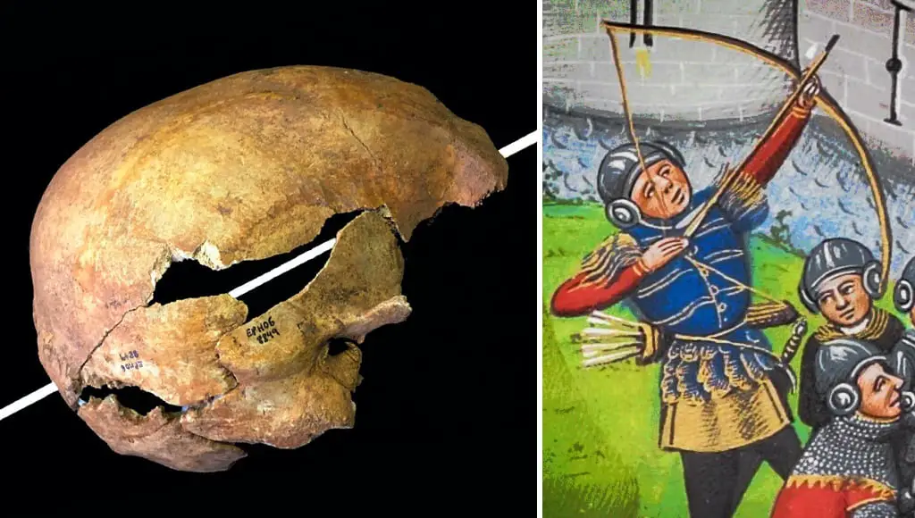 آثار اختراق سهم لجمجمة مقاتل من العصور الوسطى
