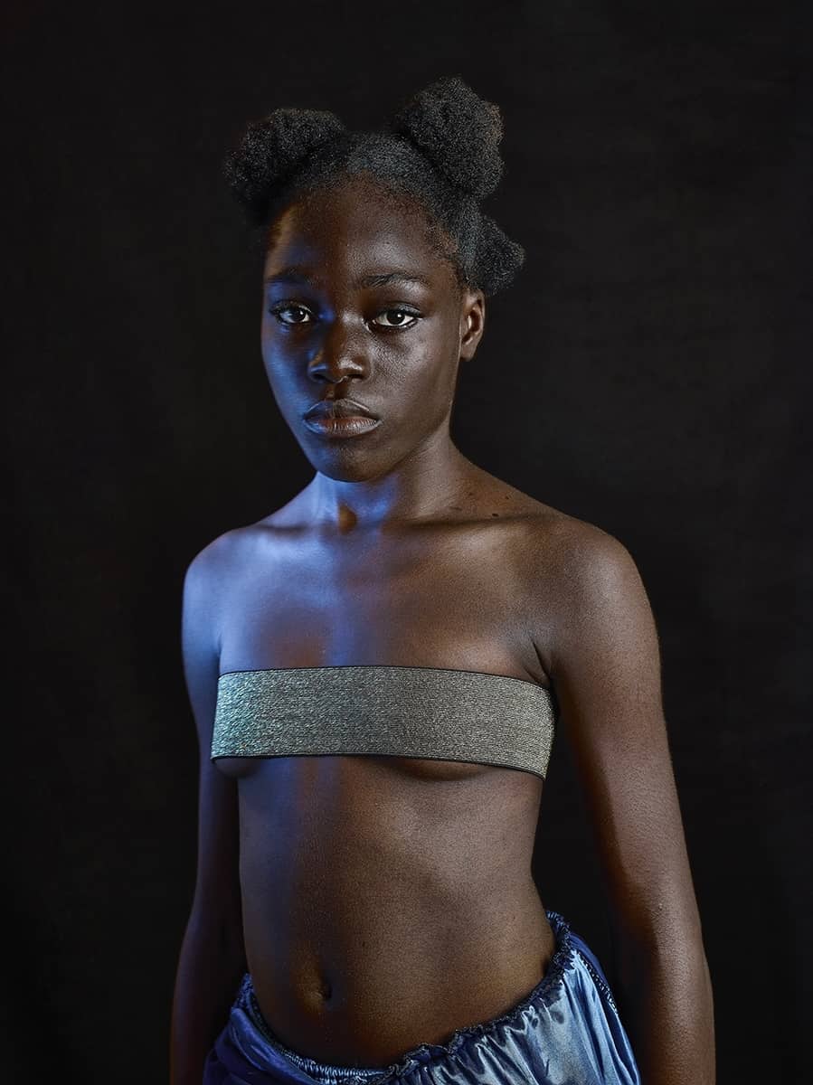 فتاة صغيرة يتم تضميد صدرها بنية تسطيحه حتى لا ينمو لديها ثديان. صورة: Vice France